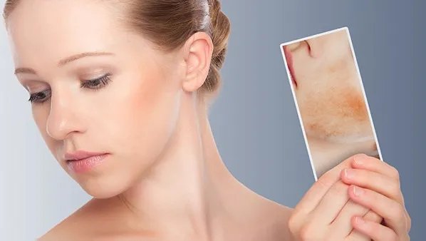 皮肤偏黄怎么美白