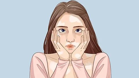 如何治疗白癜风