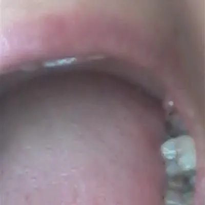 舌头疼是什么原因