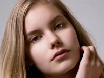 玻尿酸隆鼻能保持多久