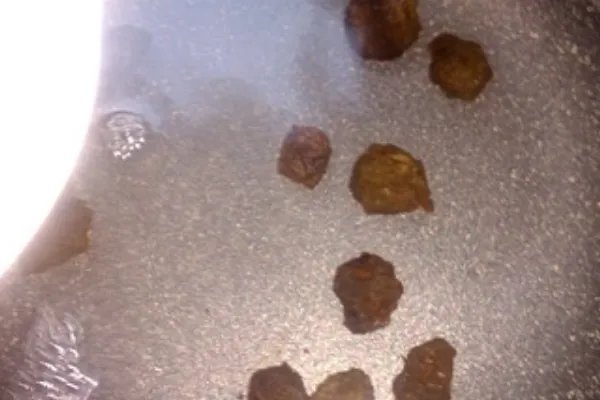 酸梅有什么功效？