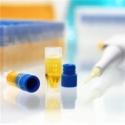 乙肝症状有哪些