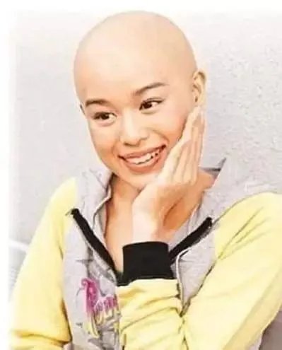 国内外有哪些明星秃头了依然很帅的？