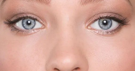 韩式无痕双眼皮要恢复多久