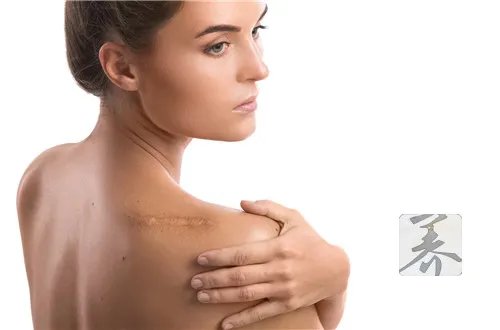 激光祛疤后有效果吗