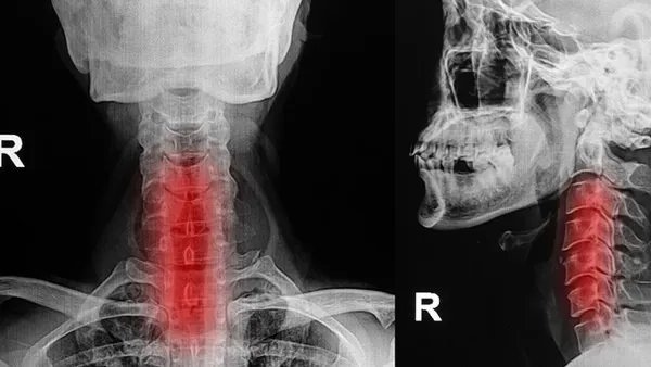 气管炎的治疗方法