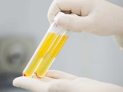 怎样区别是不是白癞风-白癞风主要表现在哪里