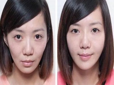 丰面颊价格是怎样的