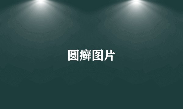 圆癣图片