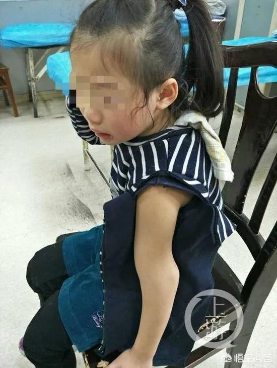 重庆一女童在幼儿园摔骨折，家长怀疑是老师报复，你怎么看？