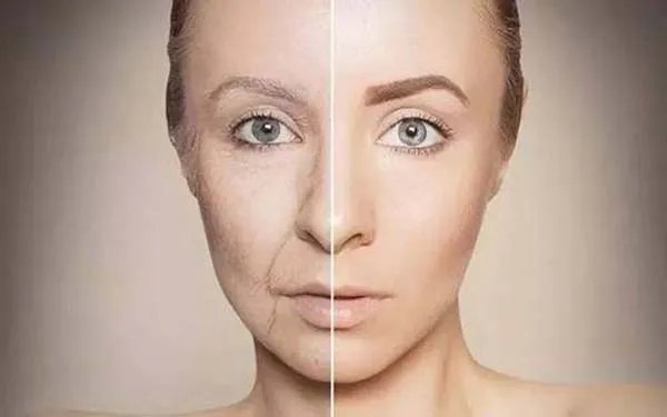 激光祛斑的费用