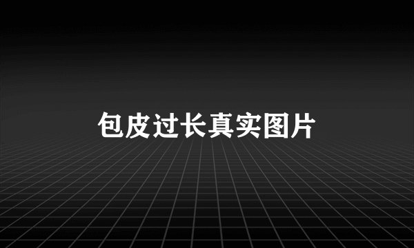 包皮过长真实图片