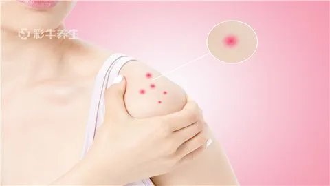 身上长红点怎么回事
