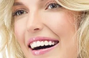 瑞蓝玻尿酸多少钱