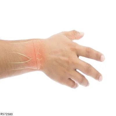 尺骨茎突炎的治疗方法有哪些