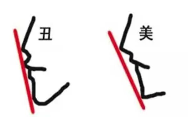 北京肋软骨隆鼻医院哪里比较好