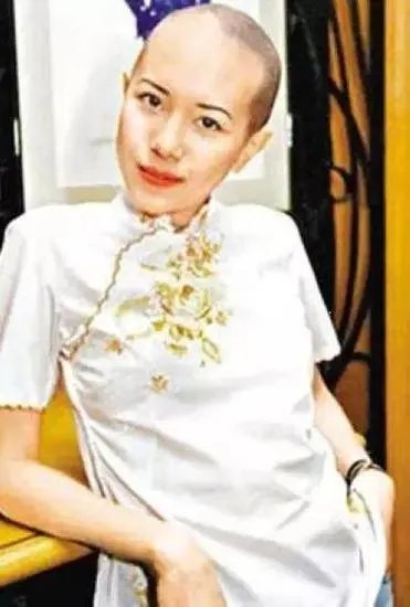 国内外有哪些明星秃头了依然很帅的？