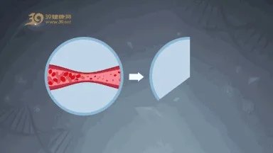 过年、春运防意外...花5分钟学这几种急救技能