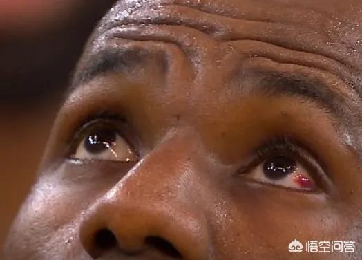 总决赛第一场裁判报告，改判LBJ阻挡犯规正确2次漏判不利骑士，大家如何看待？