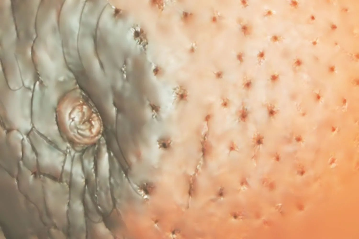 乳腺恶性肿瘤图片