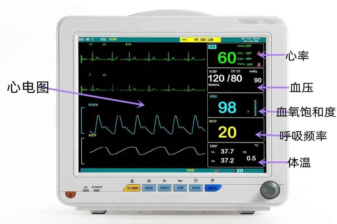 心电监护仪上的详细图解