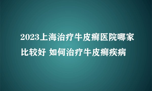 2023上海治疗牛皮癣医院哪家比较好 如何治疗牛皮癣疾病