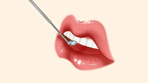 舌苔发白是啥原因