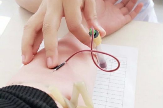 总胆红素偏高的原因是什么