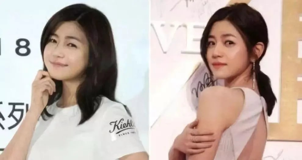 大S瘦脸前后判若两人:不手术、不打针,如何在一个月内瘦出明星V脸?