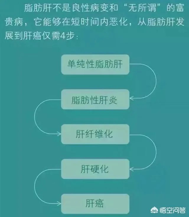 年纪轻轻中度脂肪肝，医生让减肥，你们一个月减了多少？