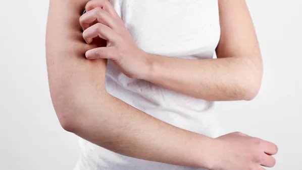 身上起小红点很痒怎么办