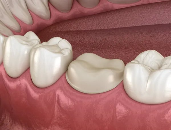 什么牌子牙膏美白牙齿效果好