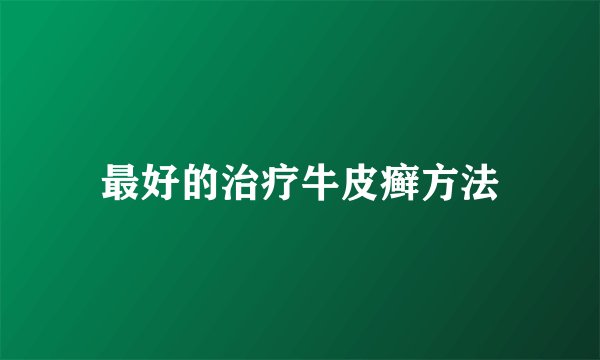 最好的治疗牛皮癣方法
