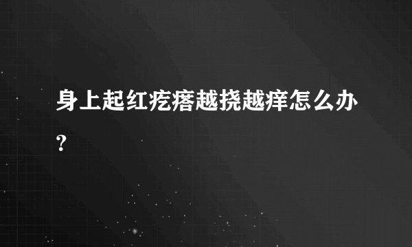 身上起红疙瘩越挠越痒怎么办？