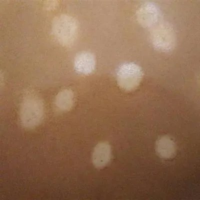 芒果过敏怎么办