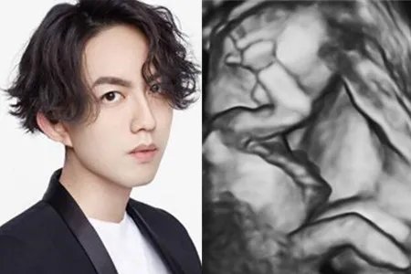 林宥嘉胎动初体验  妻子怀孕6月马上升级当爸妈