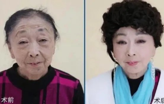 当年声称自己不后悔，娶了60岁整容老太的25岁小伙子，现在怎样了？