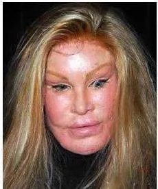 整容成猪鼻!韩国女星不小心撞断鼻子再次整容,术后仍像二师兄,你怎么看?