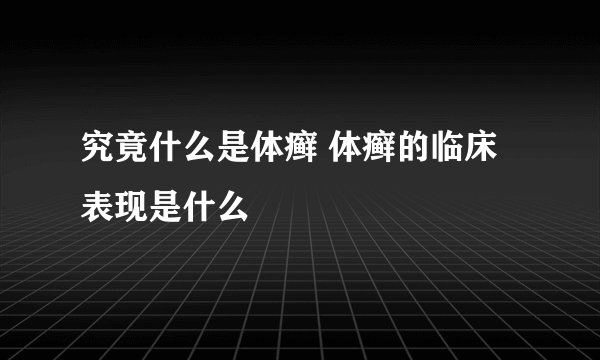 究竟什么是体癣 体癣的临床表现是什么