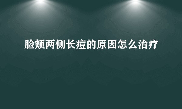 脸颊两侧长痘的原因怎么治疗