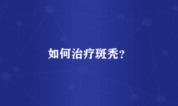如何治疗斑秃？