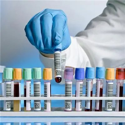 膀胱癌症如何确定