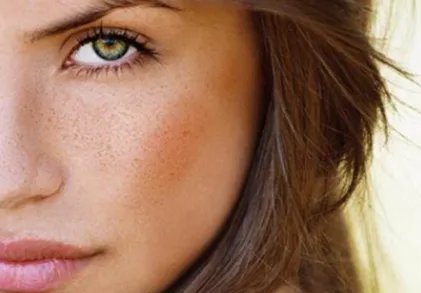 成都去黄褐斑整形好的医院是哪个 | 费用多少钱_怎么样才可以去黄褐斑。