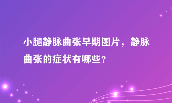小腿静脉曲张早期图片，静脉曲张的症状有哪些？