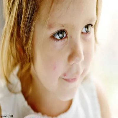 百日咳疫苗是什么 打百日咳疫苗免费还是自费