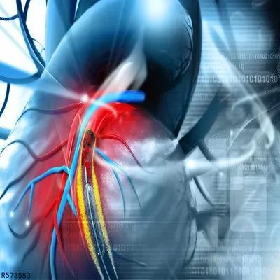 脑供血不足的原因有哪些 警惕四个原因会引起脑供血不足