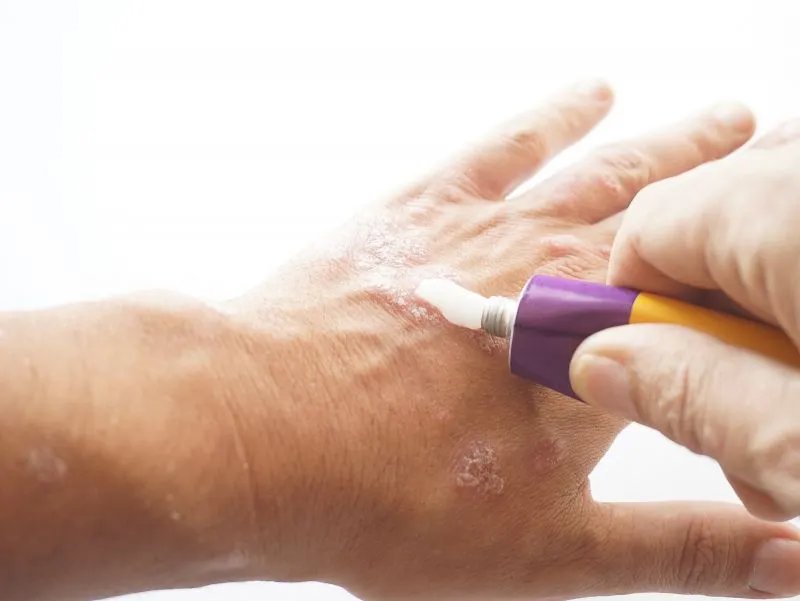 利福平乳膏说明书