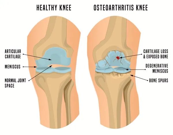 益赛普现在多少钱一支