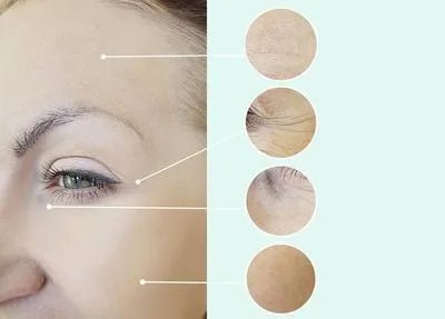 眼袋的手术费用要多少