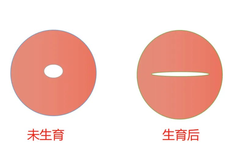 宫口是指什么部位图片